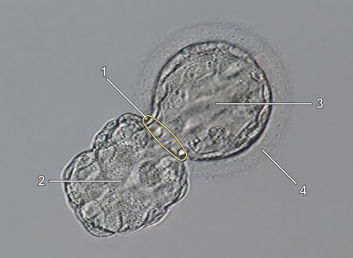 Hatch Asistido (Eclosión Asistida)